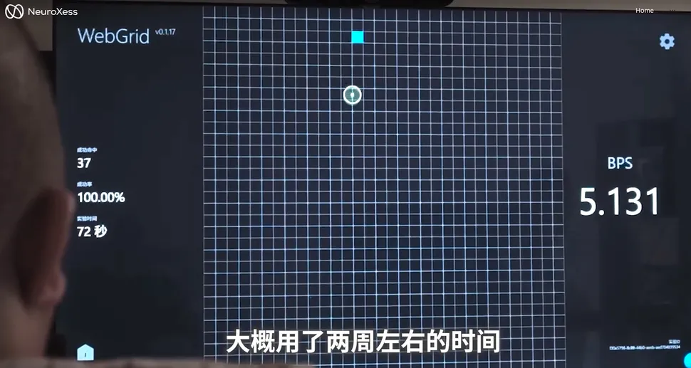 Пациент управляет курсором. Источник 